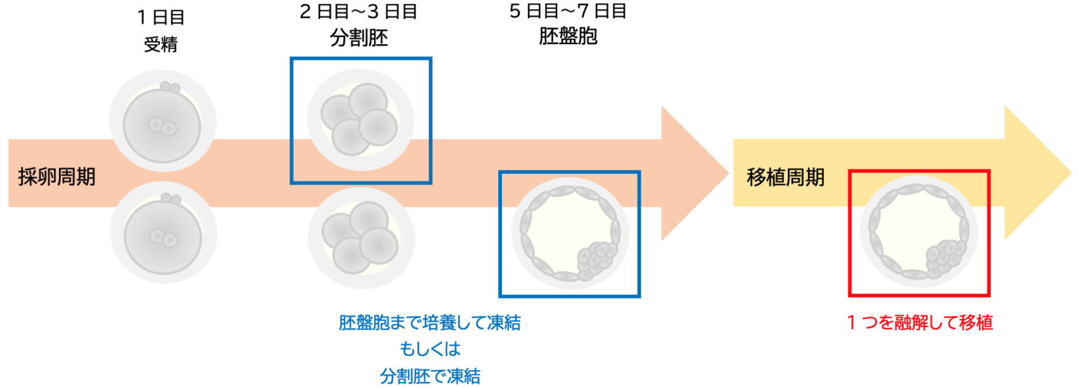 胚移植について - 慶愛クリニック 体外受精 一般不妊治療 不妊検査 不育症 豊島区