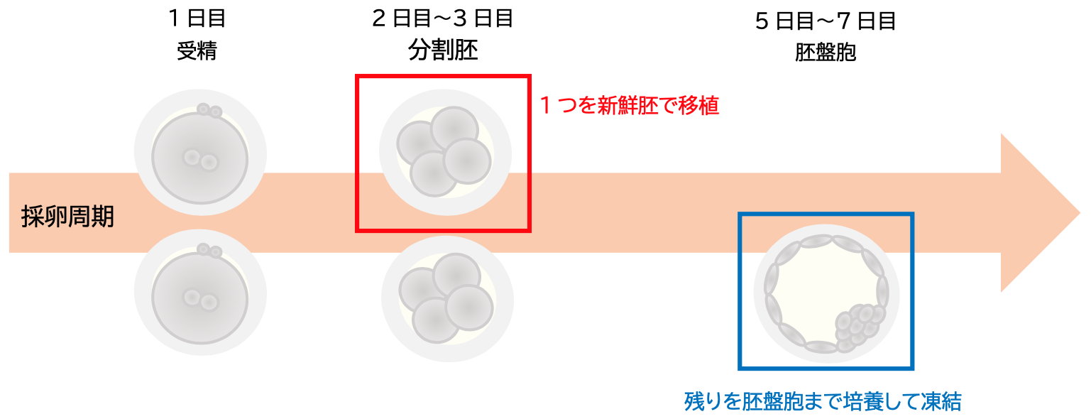 胚移植について - 慶愛クリニック 体外受精 一般不妊治療 不妊検査 不育症 豊島区